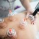 Voordelen van cupping massage  2 cupping rug