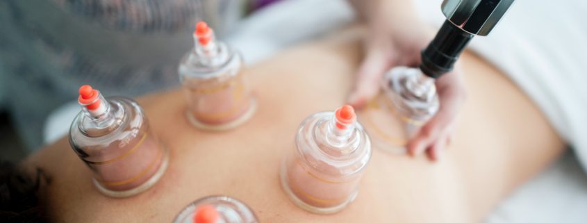 Voordelen van cupping massage 1 cupping rug