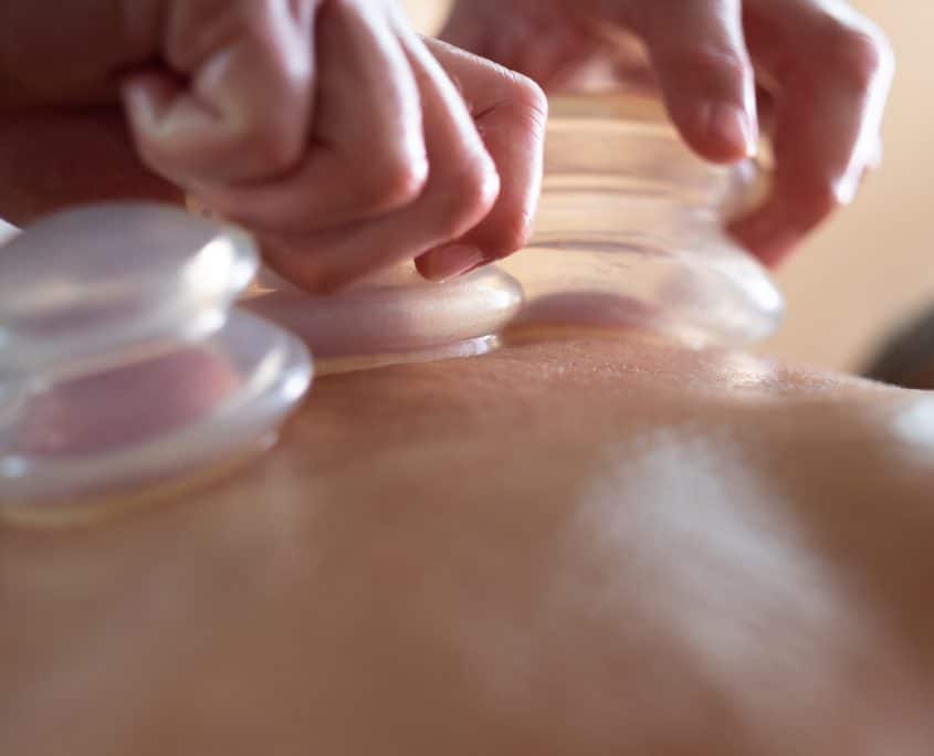 massage cupping 5